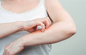 Bọ ve cắn - Hình ảnh minh họa